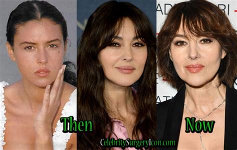 Monica Bellucci Before and After Plastic Surgery: Boob, Face.